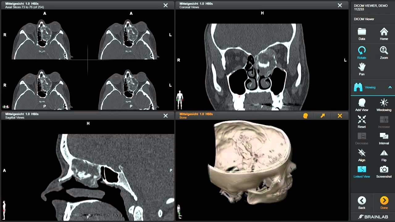 Medical image viewer