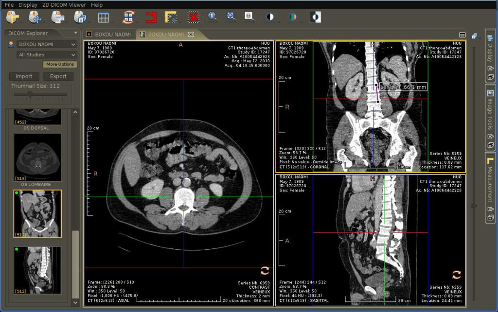 Medical image viewer